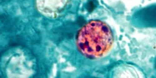 What you need to know about cyclosporiasis: How it spreads, how it's treated