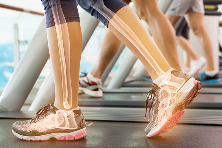The right way to exercise for bone health