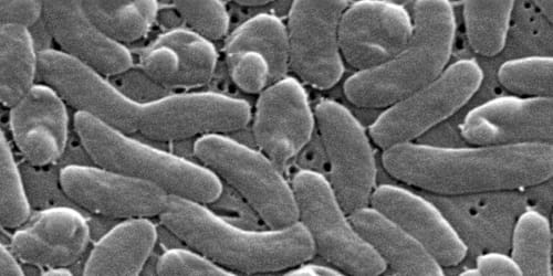 Fourth Florida resident dies from ‘flesh-eating’ bacteria