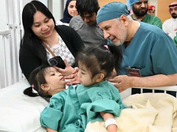 Conjoined twins separated following six-hour surgery