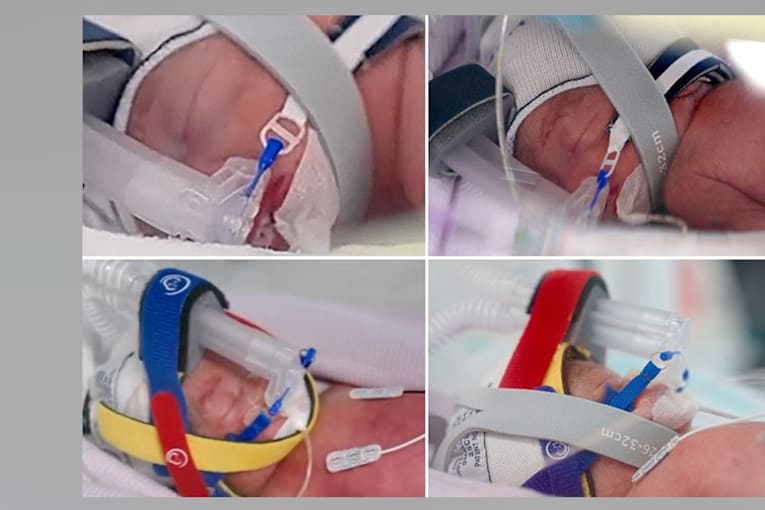 Woman becomes mom of 8 with birth of rare identical quadruplet daughters