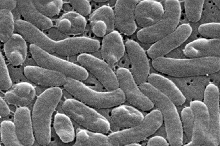 Health officials urge caution for Gulf Coast beachgoers during surge of deadly bacterial infections