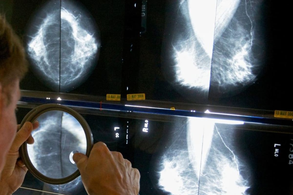 Breast Cancer Awareness Month highlights early detection - AOL