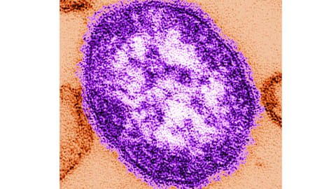 Pennsylvania reports first 2 measles deaths in the US this year, both people unvaccinated