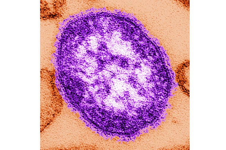 Pennsylvania reports first 2 measles deaths in the US this year, both people unvaccinated