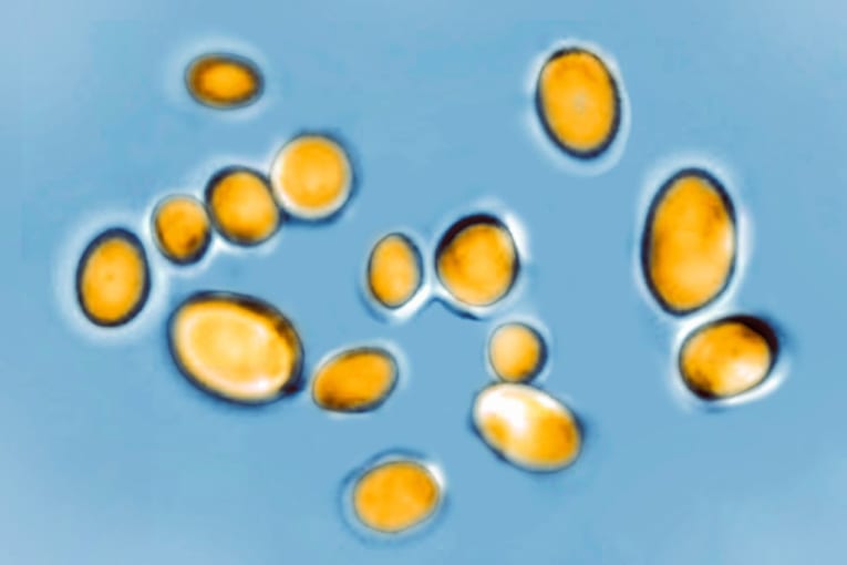 Deadly fungus confirmed in 23 states, and it&rsquo;s nearly impossible to treat

