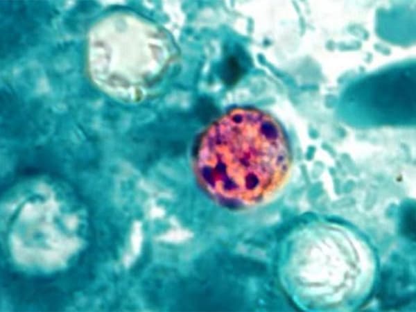 More than 300 confirmed cases of foodborne parasitic illness in Michigan
