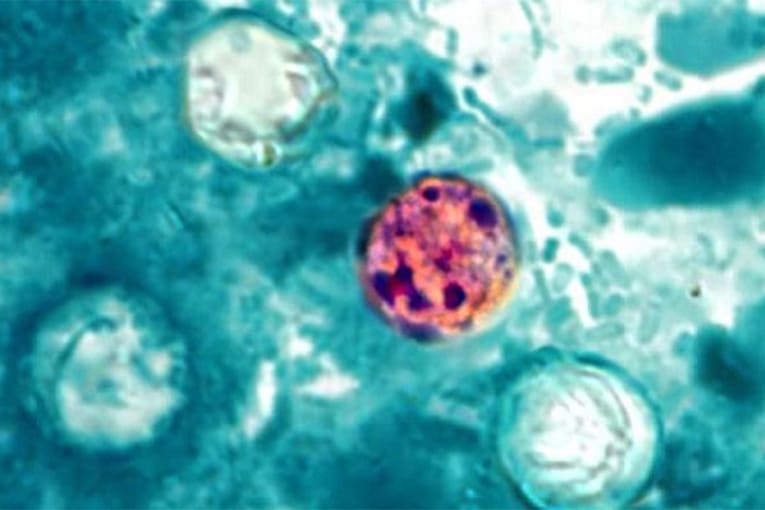More than 300 confirmed cases of foodborne parasitic illness in Michigan as outbreak continues to grow