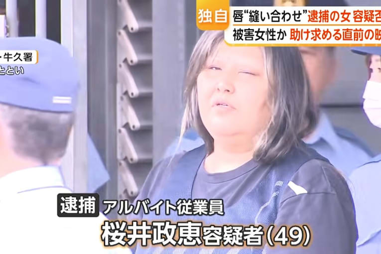Woman arrested in Japan for ‘sewing housemate’s lips shut’