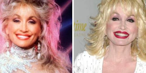 Dolly Parton's plastic surgery journey: Every cosmetic procedure she admitted to having