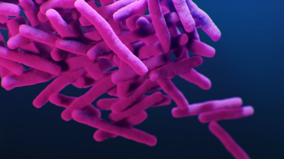 Tuberculosis cases reportedly traced back to California strip club