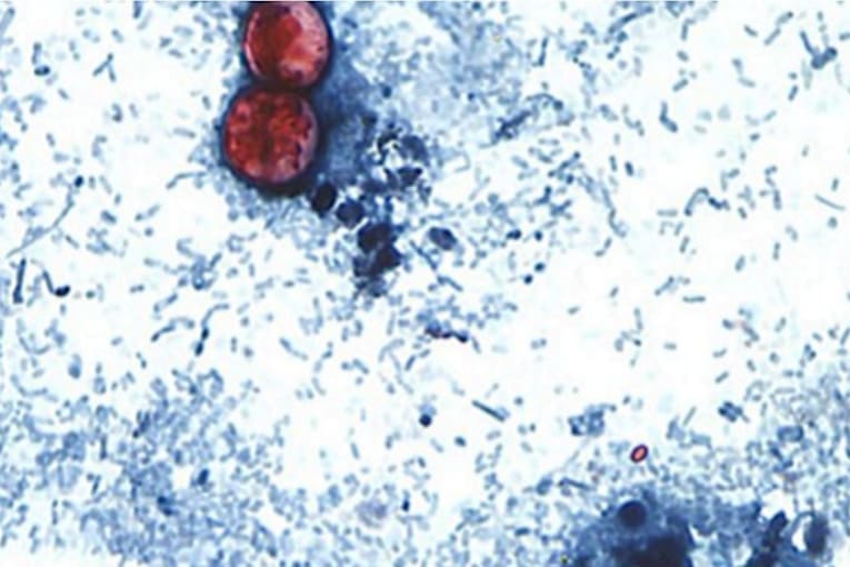 Cyclosporiasis cases top 1,200 in Michigan, health officials say