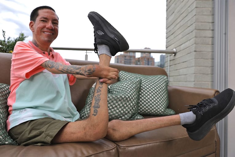 Man, 32, living with &lsquo;backward knees&rsquo; finds joys through music, dancing: &lsquo;I like being me&rsquo;