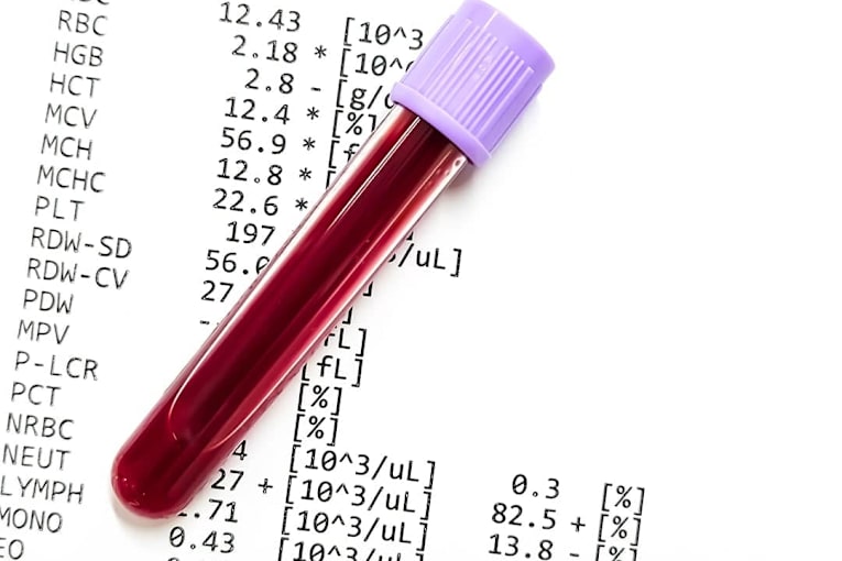 Blood tests are easier to order than ever. Doctors warn they're easy to misread