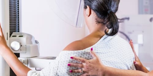 Breast cancer can show up on the skin, research shows