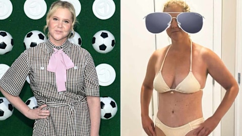 Amy Schumer shows off ongoing weight loss in new selfie, says her C-section scar makes her a &lsquo;warrior&rsquo;