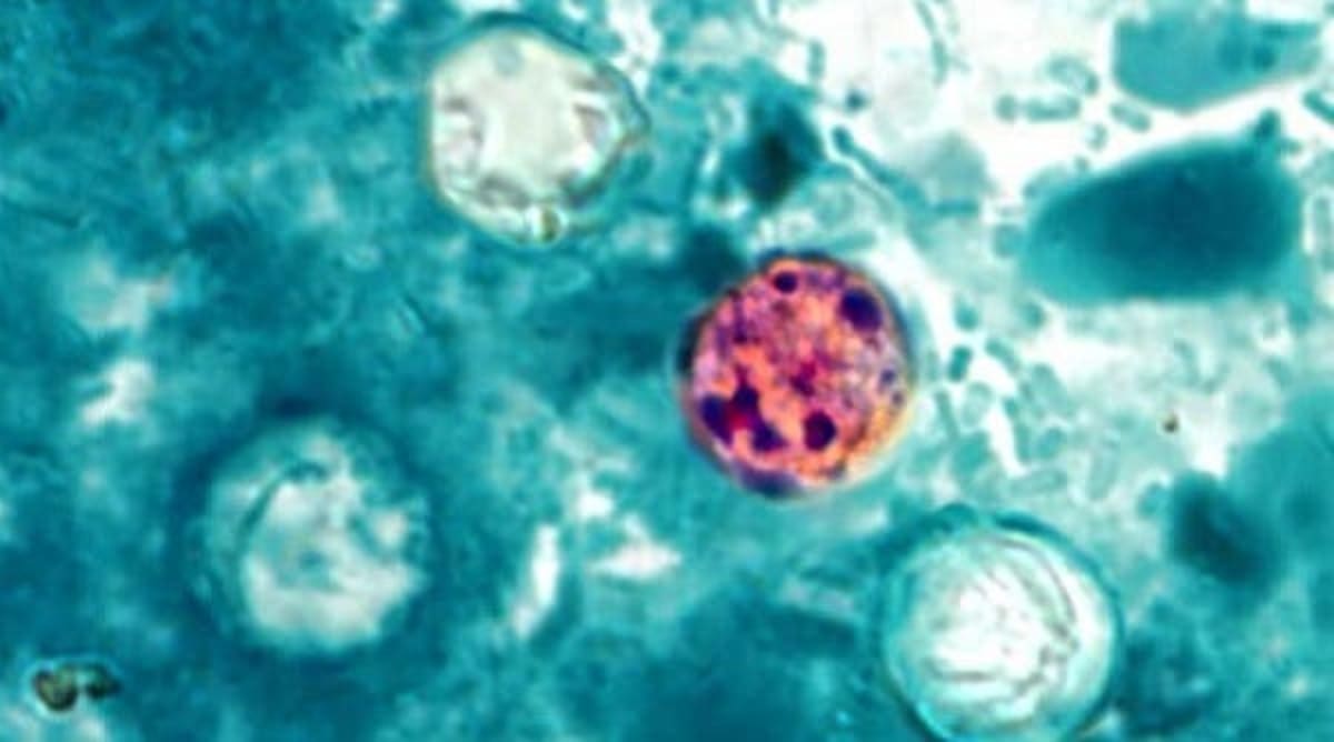 No end in sight for cyclospora outbreak as Ohio diarrhea cases surge - AOL