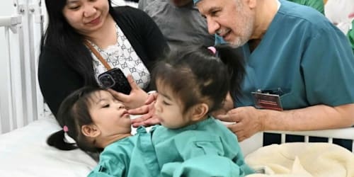 Conjoined twins separated following six-hour surgery