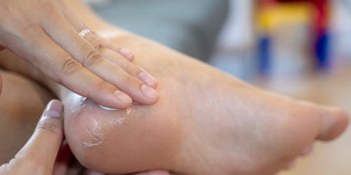 Struggling with cracked heels? Podiatrists say your shoes might be to blame