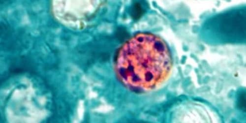 More than 300 confirmed cases of foodborne parasitic illness in Michigan