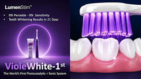 LumenStim Prepares to Launch Next-Generation Teeth Whitening System on Kickstarter
