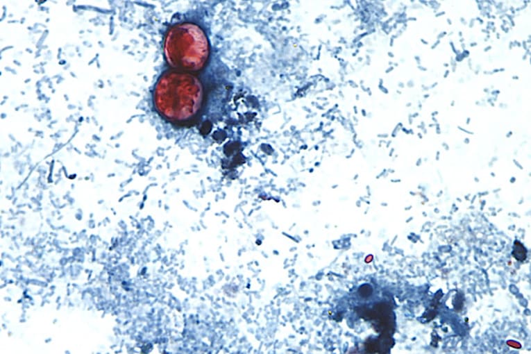 How to stay safe and still enjoy produce this summer with the outbreak of diarrhea-causing parasite