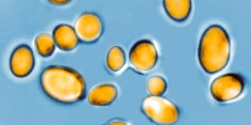 Deadly fungus rapidly spreading across US. It&rsquo;s nearly impossible to treat